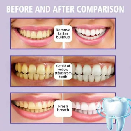 hismile Teeth Whitening Toothpaste