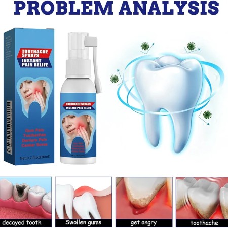 Toothache Spray 30 ml